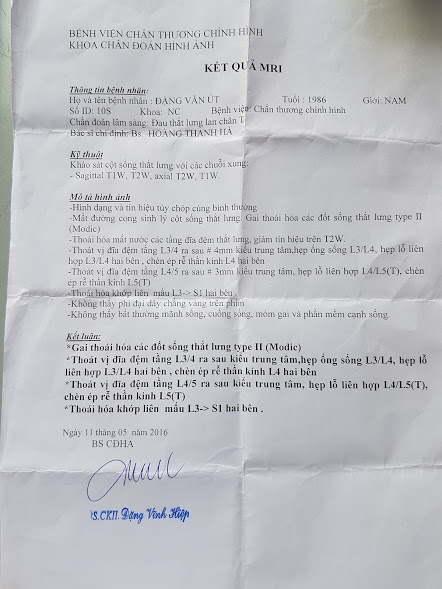 Thoát vị đĩa đệm L3 L4, L4 L5